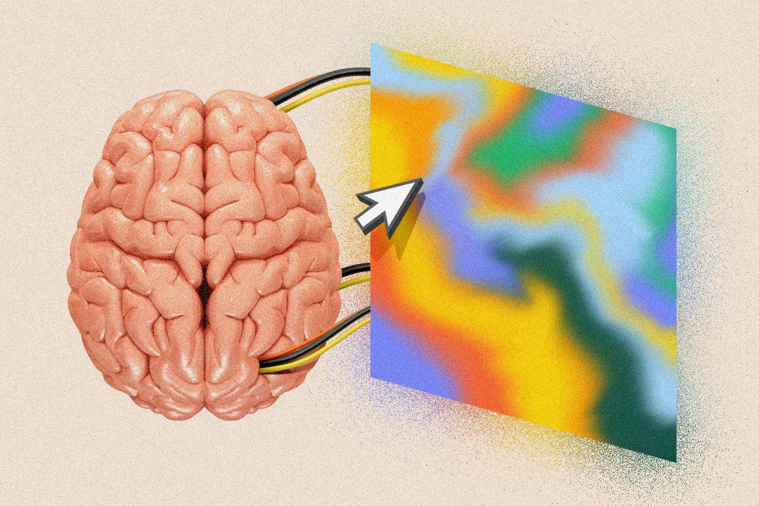 Brain connected to a monitor displaying a psychedelic pattern